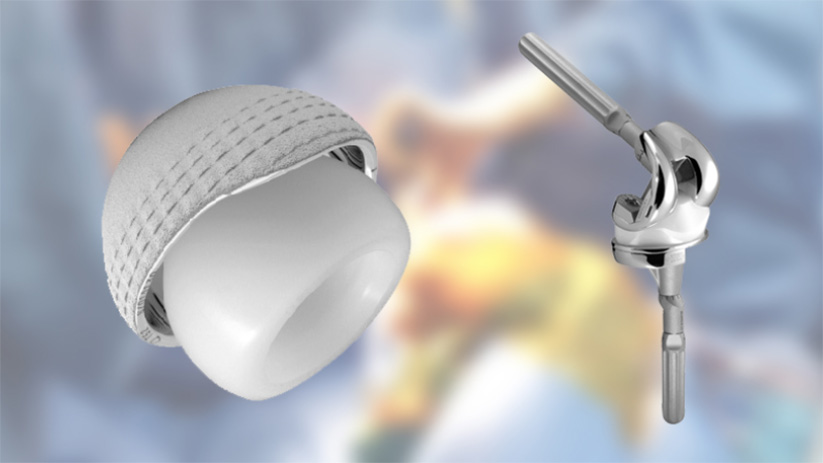 Amplitude Surgical : introduction en Bourse sur Euronext